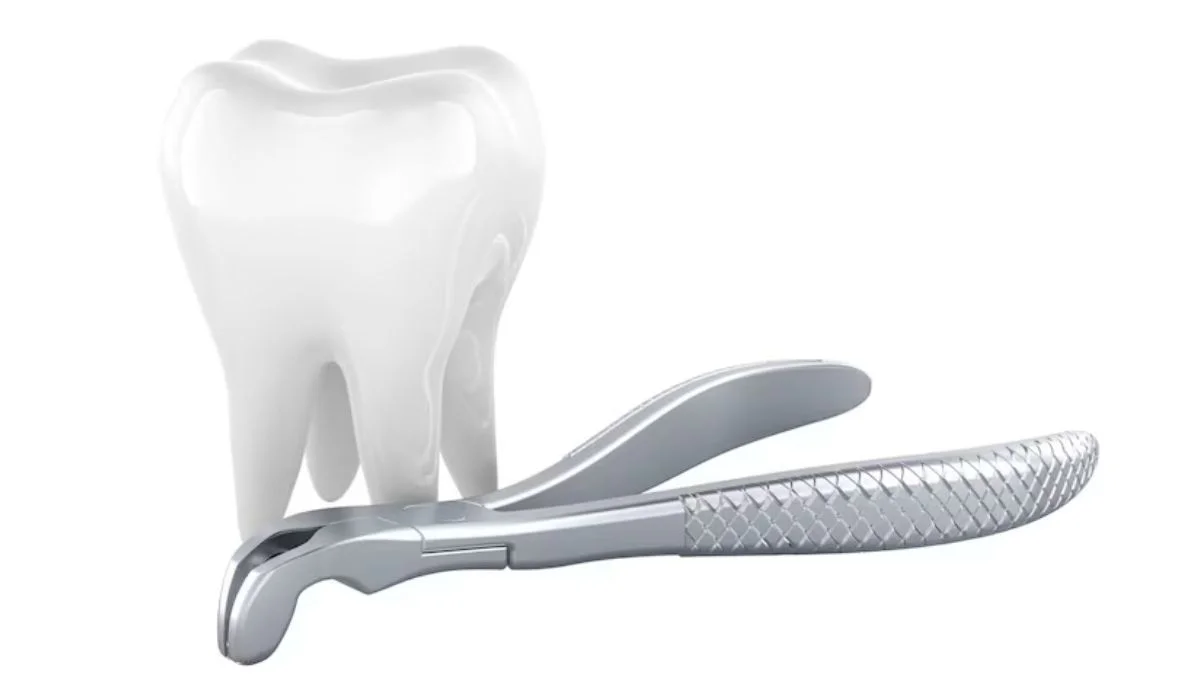 emergency tooth extraction in Burbank