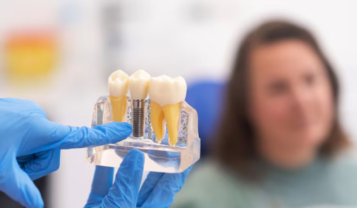 dental implant aftercare